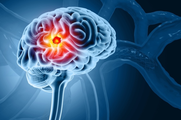 Niño de 13 años en Francia logra curarse de un cáncer cerebral mortal