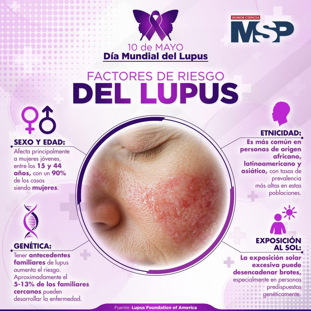 Detrás de cada paciente con lupus hay una historia de valentía y perseverancia.