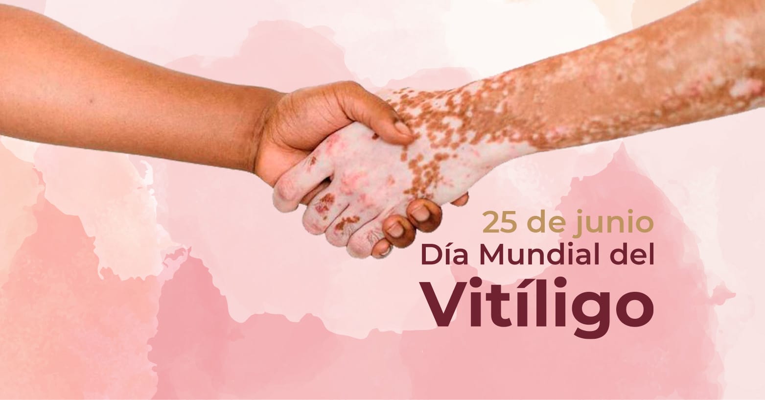 El vitíligo no cambia el valor de una persona; cada mancha es un símbolo de identidad, fortaleza y diversidad.