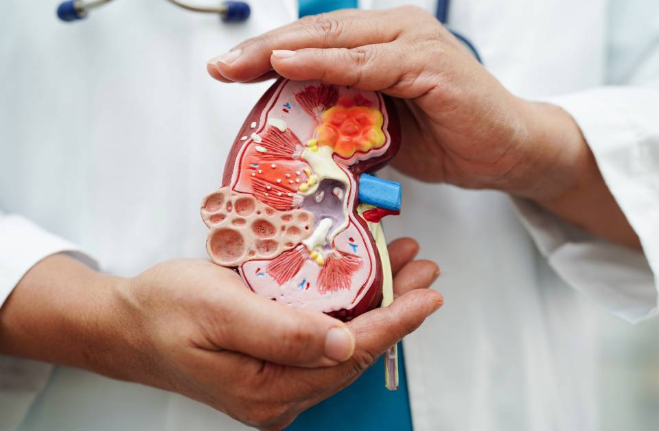 Enfermedad Renal Crónica.