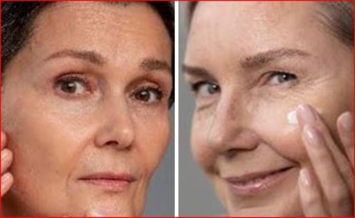 Avon- Anew Platinum-Natura- Brasil- piel bioimpresa- 3D- belleza- menopausia-